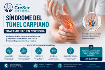 Síndrome del Túnel Carpiano Tratamiento en Córdoba