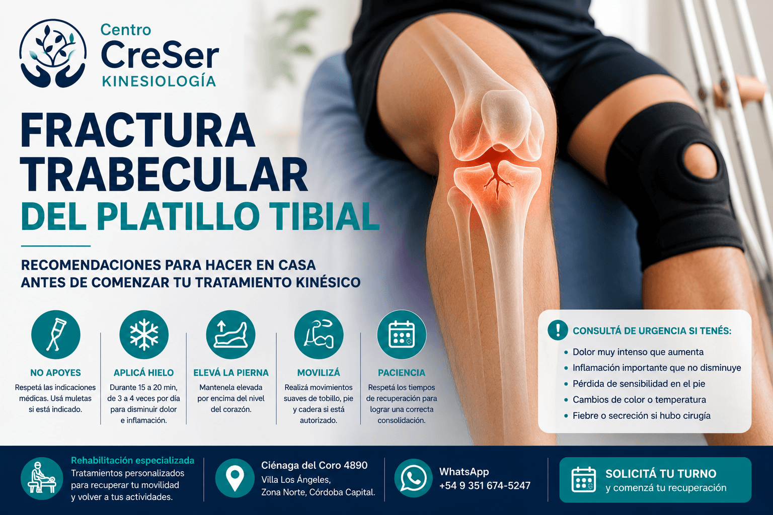 Fractura trabecular del platillo tibial | Centro CreSer